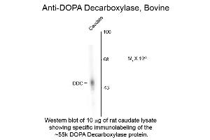 Western blot of DOPA Decarboxylase Bovine Antibody Western Blot of Rabbit anti-DOPA Decarboxylase Bovine Antibody.