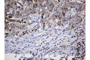 Image no. 5 for anti-NADH Dehydrogenase (Ubiquinone) 1 beta Subcomplex, 10, 22kDa (NDUFB10) antibody (ABIN1499672) (NDUFB10 anticorps)