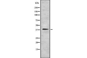 Western blot analysis STEAP1 using HT29 whole cell lysates (STEAP1 anticorps  (N-Term))