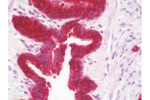 Anti-GGCT antibody IHC staining of human lung. (GGCT anticorps  (AA 139-168))