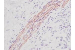 Image no. 1 for anti-KIT Ligand (KITLG) antibody (ABIN465573)