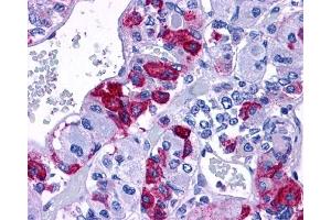 Immunohistochemical staining of Brain (Pituitary) using anti- ADCYAP1R1 antibody ABIN122519