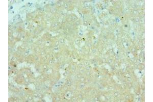 Immunohistochemistry of paraffin-embedded human liver tissue using ABIN7172781 at dilution of 1:100
