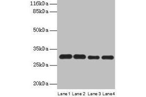 Western blot All lanes: PMM1 antibody at 2 μg/mL Lane 1: HepG2 whole cell lysate Lane 2: NIH/3T3 whole cell lysate Lane 3: 293T whole cell lysate Lane 4: Mouse brain tissue Secondary Goat polyclonal to rabbit IgG at 1/10000 dilution Predicted band size: 30 kDa Observed band size: 30 kDa (PMM1 anticorps  (AA 2-262))