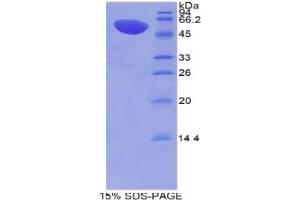 SDS-PAGE analysis of Mouse MX1 Protein. (MX1 Protéine)
