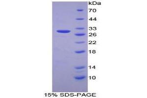 SDS-PAGE analysis of Human PSMD2 Protein. (PSMD2 Protéine)