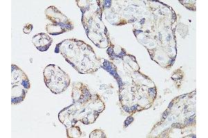 Immunohistochemistry of paraffin-embedded human placenta using MTOR antibody. (MTOR anticorps  (AA 2388-2487))