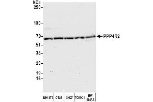 Western Blotting (WB) image for anti-Protein Phosphatase 4, Regulatory Subunit 2 (PPP4R2) (C-Term) antibody (ABIN7453641)