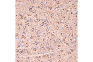 Immunohistochemistry of paraffin-embedded mouse brain using 14-3-3 gamma Rabbit mAb (ABIN7265311) at dilution of 1:100 (40x lens).