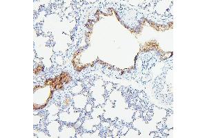 IHC analysis of TEK using anti-TEK antibody (ABIN7600762). (TEK anticorps  (AA 23-616))