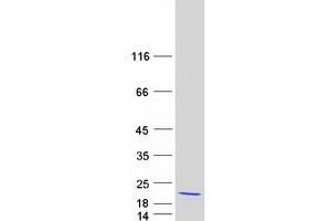 Validation with Western Blot