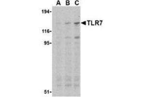 Western blot analysis of TLR7 in Daudi cell lysates with this product at (A) 0. (TLR7 anticorps  (Middle Region))