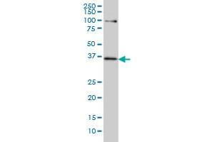 Western Blotting (WB) image for anti-Transcription Factor 19 (TCF19) (AA 17-103) antibody (ABIN598965) (TCF19 anticorps  (AA 17-103))