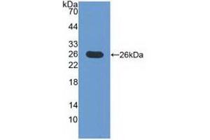 Detection of Recombinant ICOSLG, Mouse using Polyclonal Antibody to Inducible T-Cell Co Stimulator Ligand (ICOSLG)