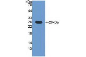 Detection of Recombinant ICOSLG, Mouse using Polyclonal Antibody to Inducible T-Cell Co Stimulator Ligand (ICOSLG) (ICOSLG anticorps  (AA 58-249))