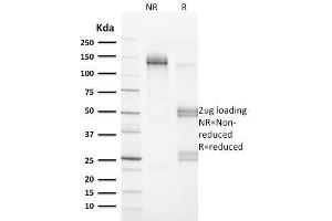 SDS-PAGE Analysis Purified VCL Mouse Monoclonal Antibody (VCL/2572).