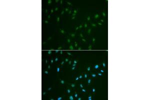 Immunofluorescence analysis of A549 cell using HSF2 antibody. (HSF2 anticorps)