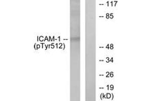 Western blot analysis of extracts from HeLa cells treated with TNF-alpha 20ng/ml 5', using ICAM-1 (Phospho-Tyr512) Antibody. (ICAM1 anticorps  (pTyr512))