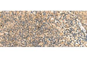 Immunohistochemistry of paraffin-embedded Human tonsil tissue using TCAP Polyclonal Antibody at dilution of 1:55(x200)