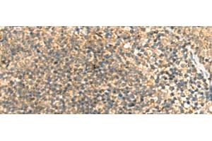 Immunohistochemistry of paraffin-embedded Human tonsil tissue using TCAP Polyclonal Antibody at dilution of 1:55(x200) (TCAP anticorps)
