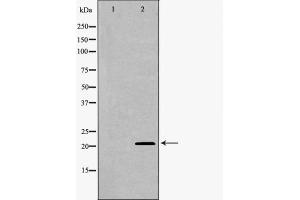 Western blot analysis UBE2M using COLO205 whole cell lysates