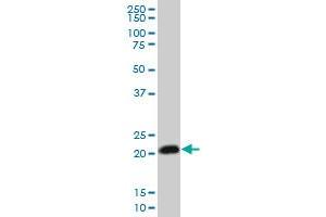 RHOC monoclonal antibody (M06), clone 1B7.