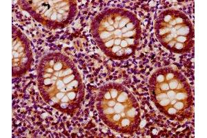 IHC image of ABIN7172718 diluted at 1:200 and staining in paraffin-embedded human appendix tissue performed on a Leica BondTM system.