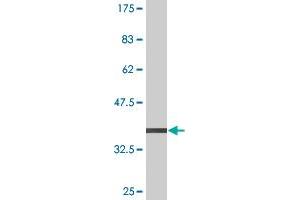 Western Blot detection against Immunogen (38.