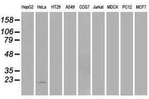 Image no. 2 for anti-Adenylate Kinase 1 (AK1) antibody (ABIN1496514) (Adenylate Kinase 1 anticorps)