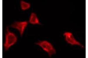 ABIN6276192 staining HeLa by IF/ICC.