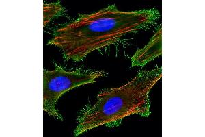 Fluorescent image of Hela cells stained with FA Antibody (Center) (ABIN1881332 and ABIN2843378). (FAM159A anticorps  (AA 89-115))