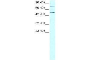 WB Suggested Anti-PIAS4 Antibody Titration:  0. (PIAS4 anticorps  (N-Term))