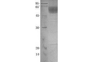 Validation with Western Blot (SERPINA6 Protein (His tag))