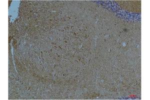 Immunohistochemistry (IHC) analysis of paraffin-embedded Mouse Brain Tissue using Kv11.