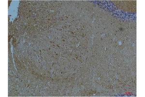 Immunohistochemistry (IHC) analysis of paraffin-embedded Mouse Brain Tissue using Kv11.