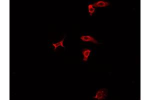 ABIN6277935 staining HepG2? (PRMT7 anticorps  (Internal Region))