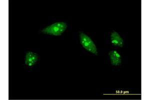Immunofluorescence of monoclonal antibody to MEOX1 on HeLa cell. (MEOX1 anticorps  (AA 165-252))