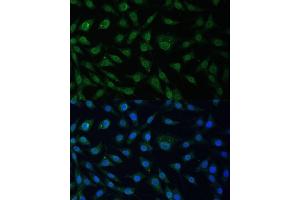 anti-Nucleoporin 214kDa (NUP214) (AA 750-1030) antibody