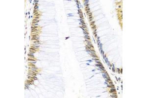 Immunohistochemistry of paraffin-embedded human colon using SKIV2L2 antibody.