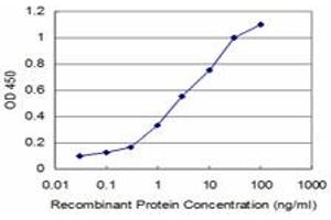 Detection limit for recombinant GST tagged RCV1 is approximately 0. (Recoverin anticorps  (AA 101-199))