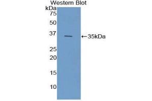 Western Blotting (WB) image for anti-Ficolin (Collagen/fibrinogen Domain Containing) 1 (FCN1) (AA 25-317) antibody (ABIN3207865) (FCN1 anticorps  (AA 25-317))