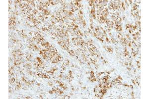 IHC-P Image Immunohistochemical analysis of paraffin-embedded TOV-21G xenograft, using AP4M1, antibody at 1:500 dilution.