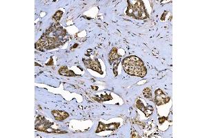 IHC analysis of SAP130 using anti-SAP130 antibody (ABIN7601247). (SAP130 anticorps  (AA 309-913))