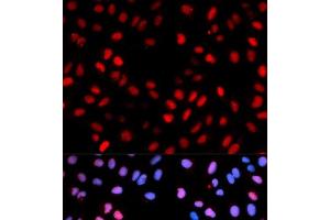 Immunofluorescence analysis of U2OS cells using Phospho-RAF1(S621) Polyclonal Antibody (RAF1 anticorps  (pSer621))