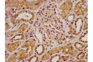 IHC image of ABIN7145800 diluted at 1:800 and staining in paraffin-embedded human kidney tissue performed on a Leica BondTM system. (BAZ2B anticorps  (AA 139-240))