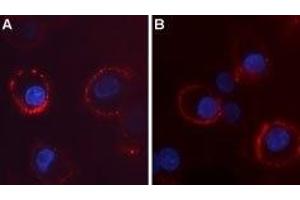 Expression of CaVα2δ4 in rat PC-12 cells - Cell surface detection of CaVα2δ4 in intact living PC-12 cells.