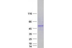 Validation with Western Blot