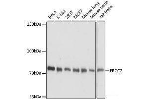 Western blot analysis of extracts of various cell lines using ERCC2 Polyclonal Antibody at dilution of 1:1000. (ERCC2 anticorps)