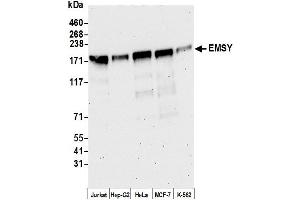 anti-Chromosome 11 Open Reading Frame 30 (C11orf30) (C-Term) antibody