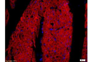 Formalin-fixed and paraffin embedded rat heart tissue labeled with Rabbit Anti-DOG-1/TMEM16A Polyclonal Antibody, Unconjugated at 1:200 followed by conjugation to the secondary antibody and DAB staining.